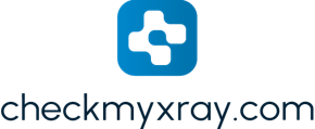 Check My Xray